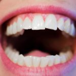 Nowoczesna technika wykorzystywana w salonach stomatologii estetycznej być może spowodować, że odzyskamy piękny uśmiech.
